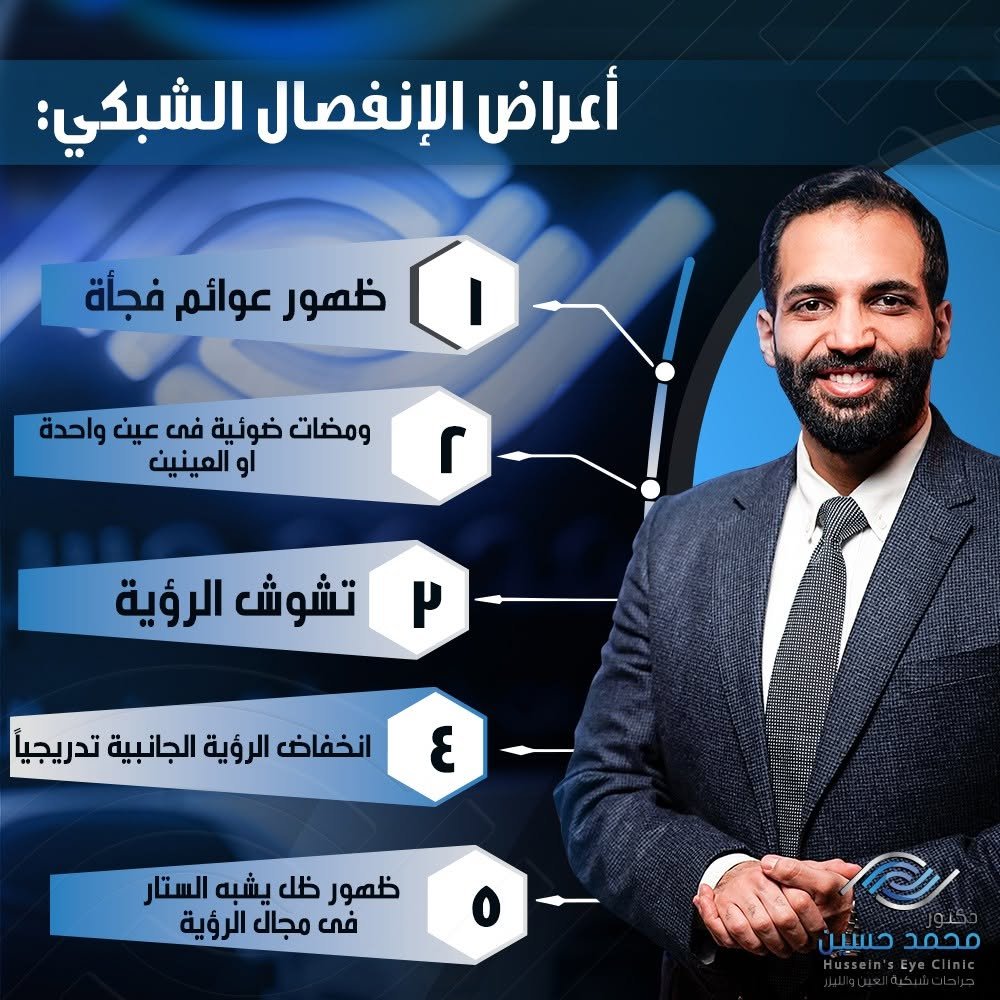 أعراض انفصال الشبكية.. متى يجب زيارة الطبيب؟